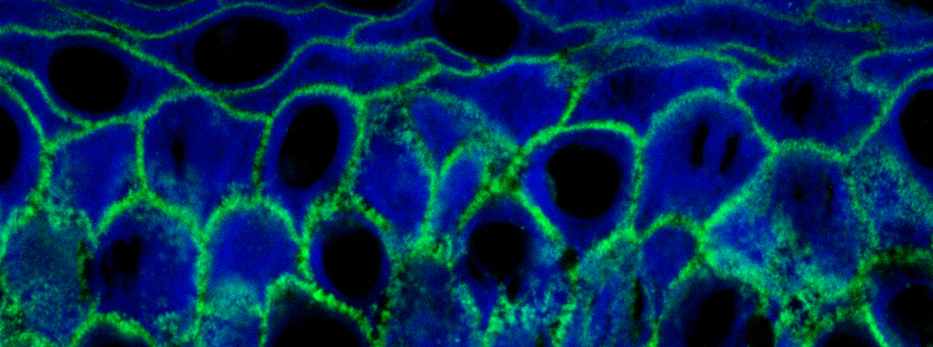 Direkte Immunfluoreszenzmikroskopie (DIF) Dermathohistologie